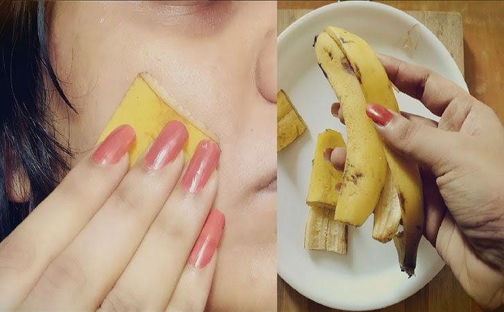 22 Surprising Things Banana Peels Can Do For You_38