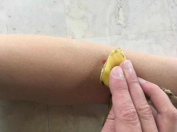 22 Surprising Things Banana Peels Can Do For You_55